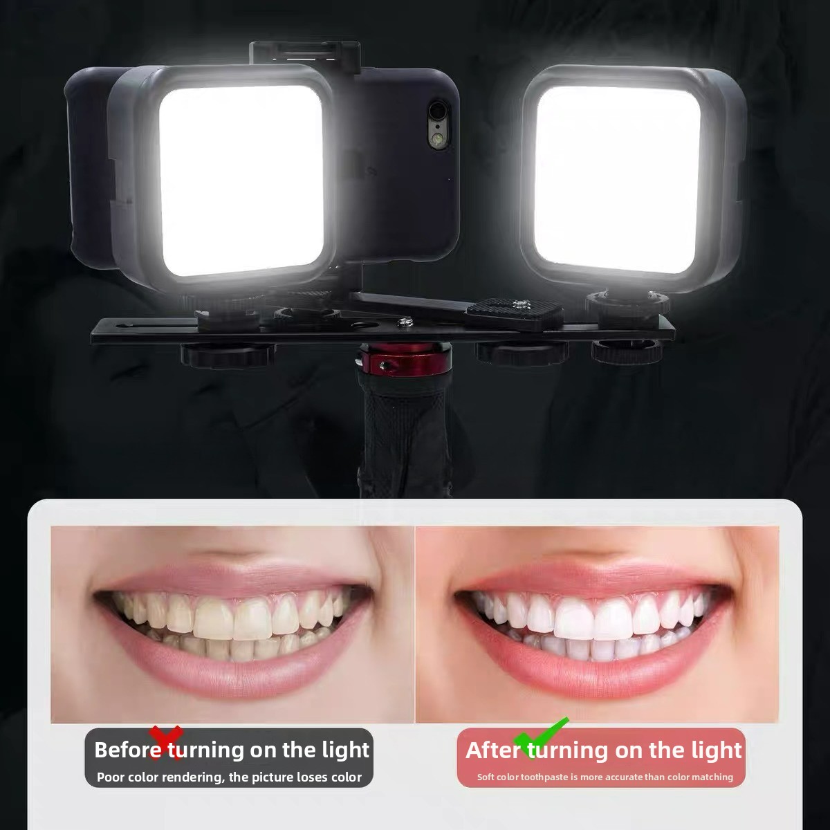 Dental Photography Light with  - Photography Mobile Lighting review and price