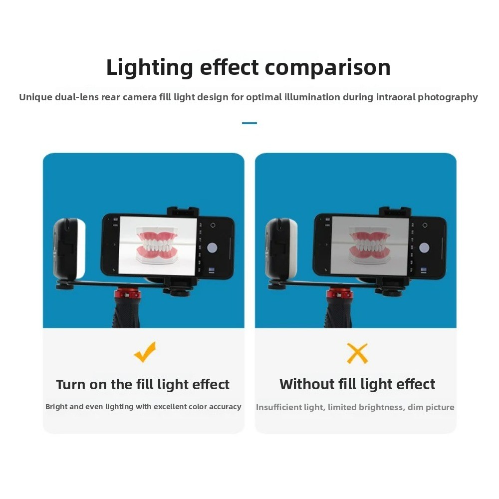 Dental Photography Light, Blue - Photography Lighting Kit Portable review and price
